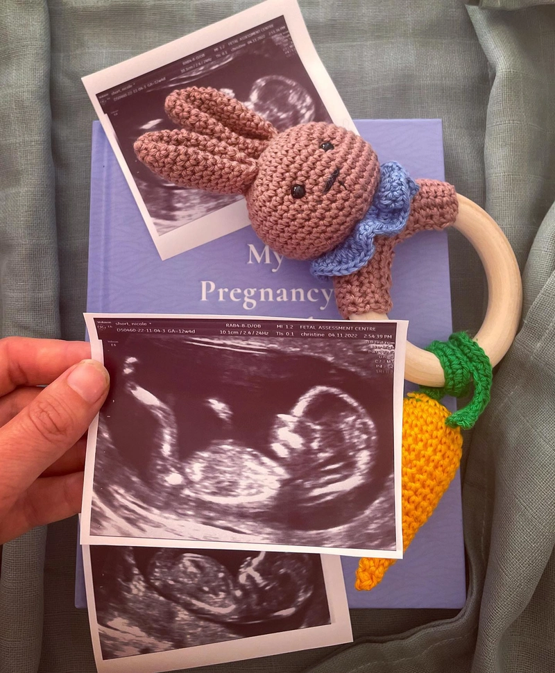 宝宝 Bongers 即将出生