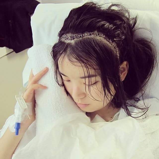 Hiro 因脑部手术留下了疤痕